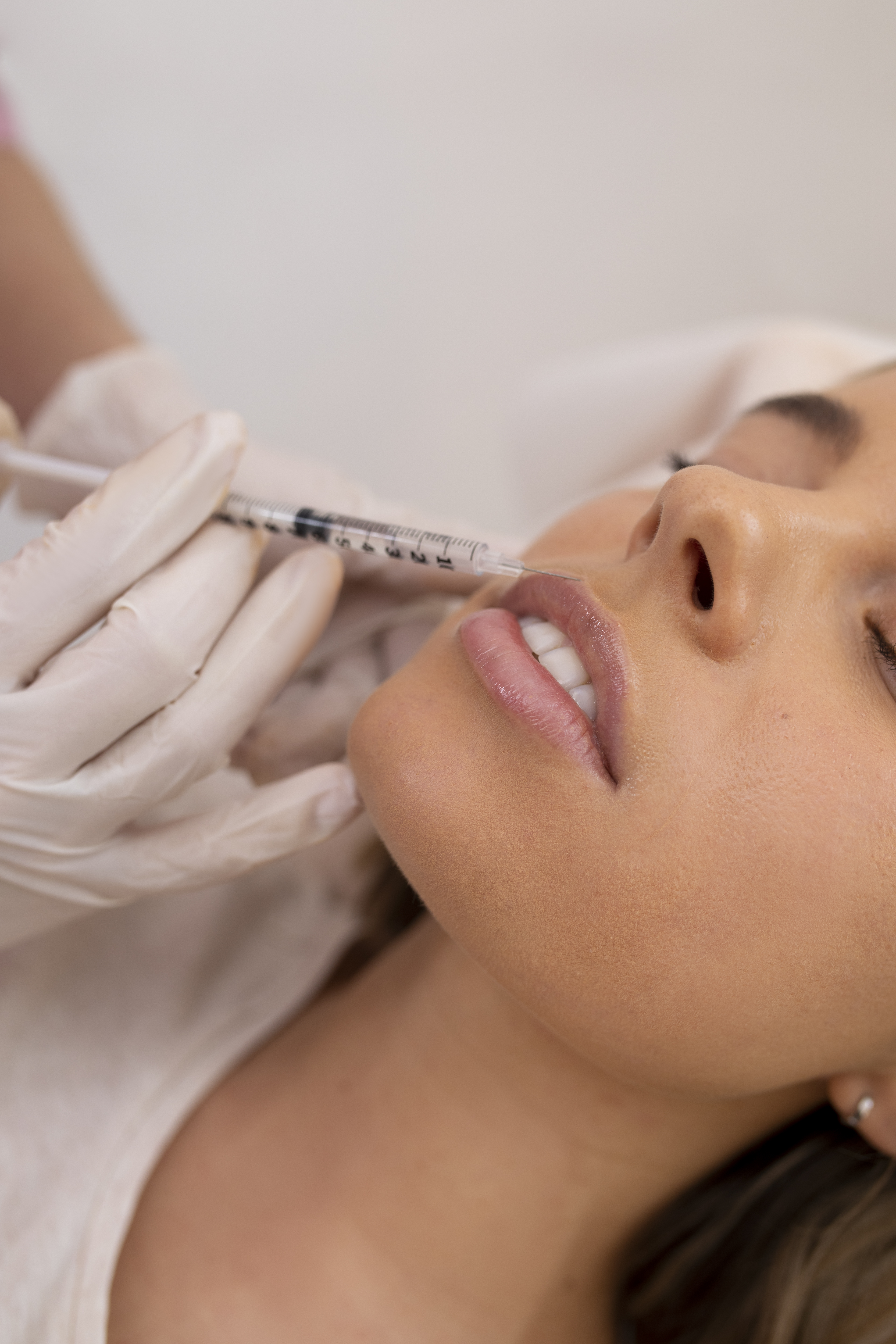 Dermal Fillers - Volume Restoration